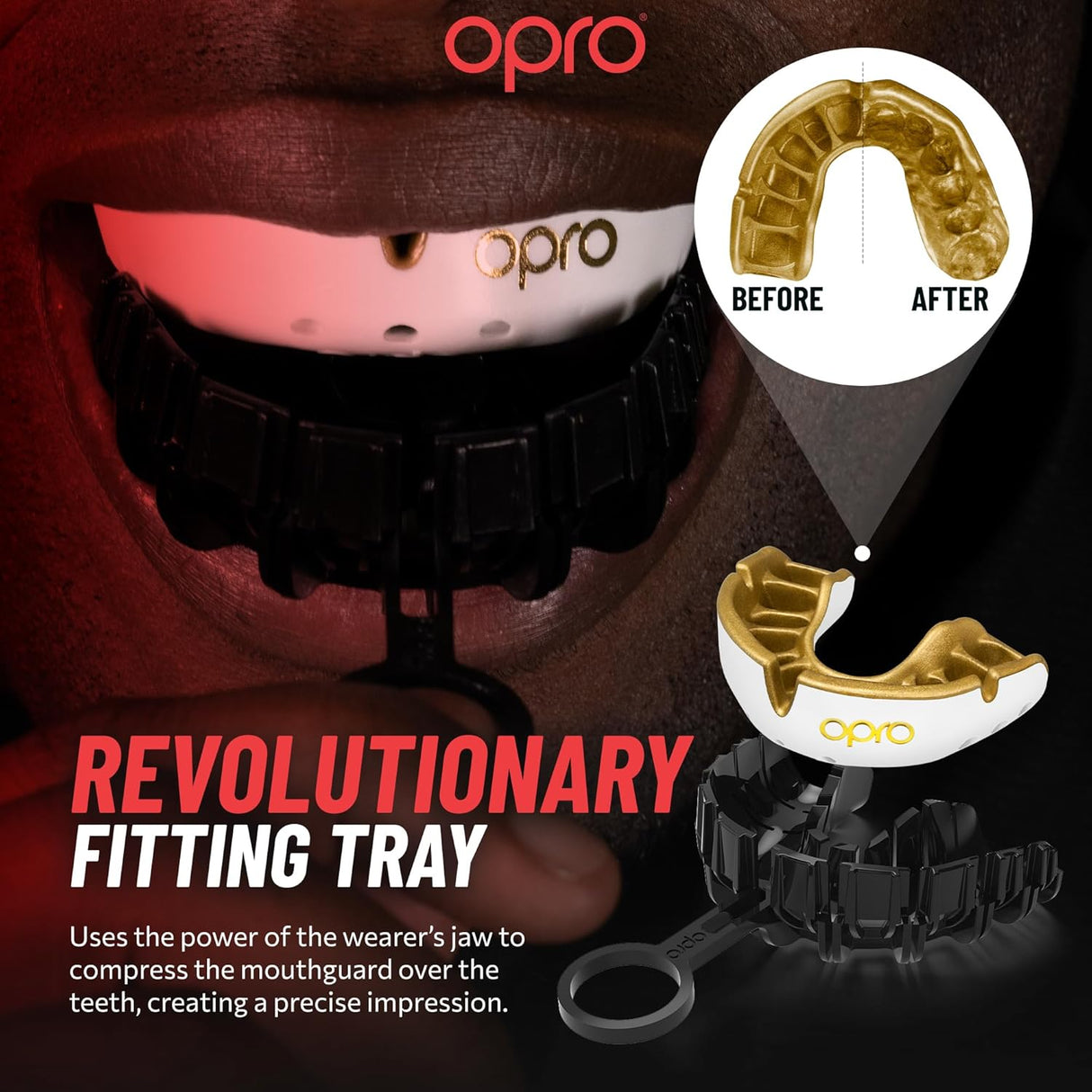 Gold Level Blue Mouthguard for Braces