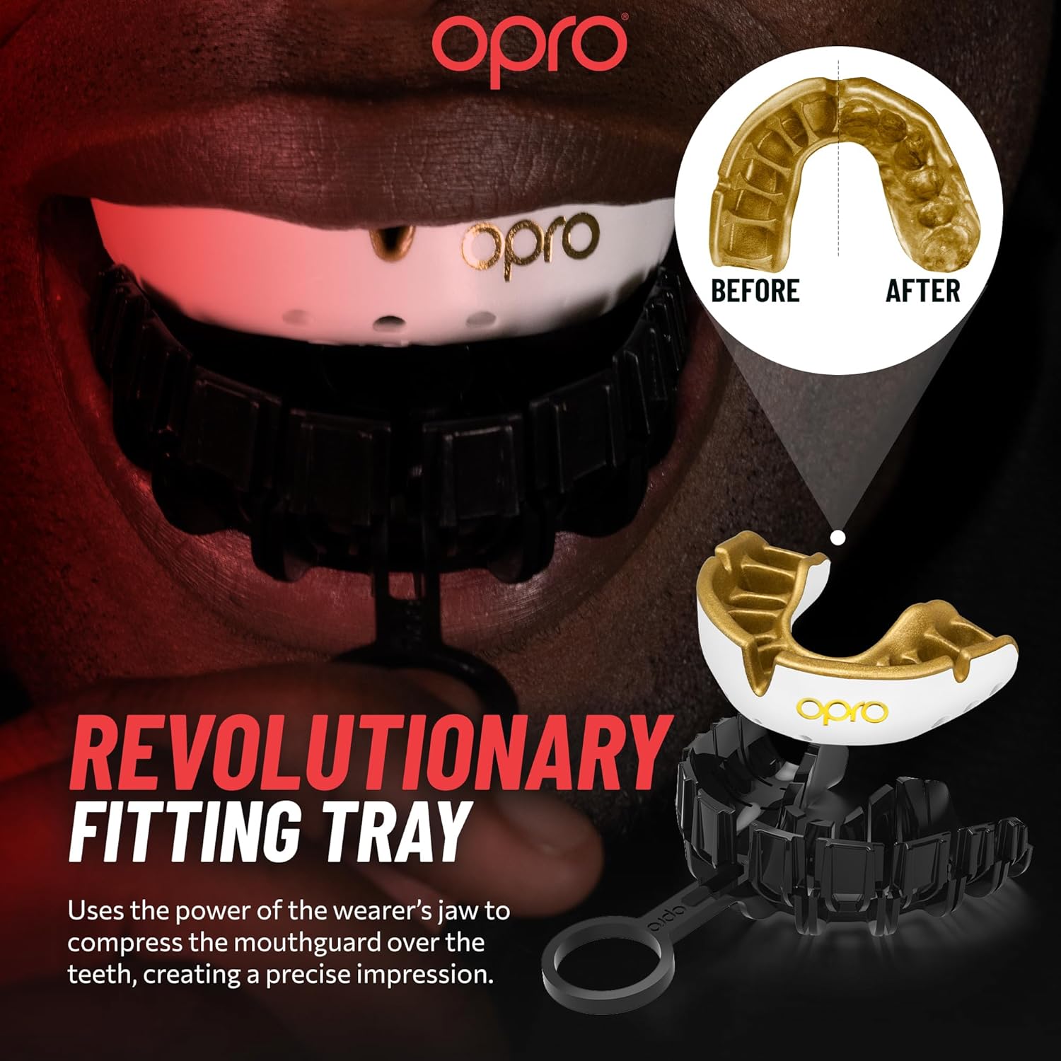 Gold Level Blue Mouthguard for Braces