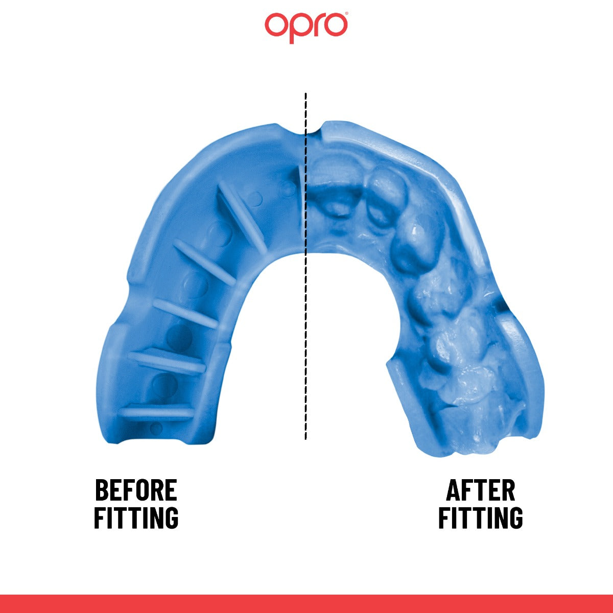 Silver Level Blue Mouthguard
