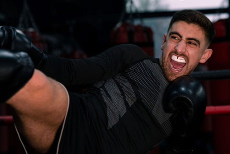 Everything You Need to Know About Boil and Bite Mouthguards