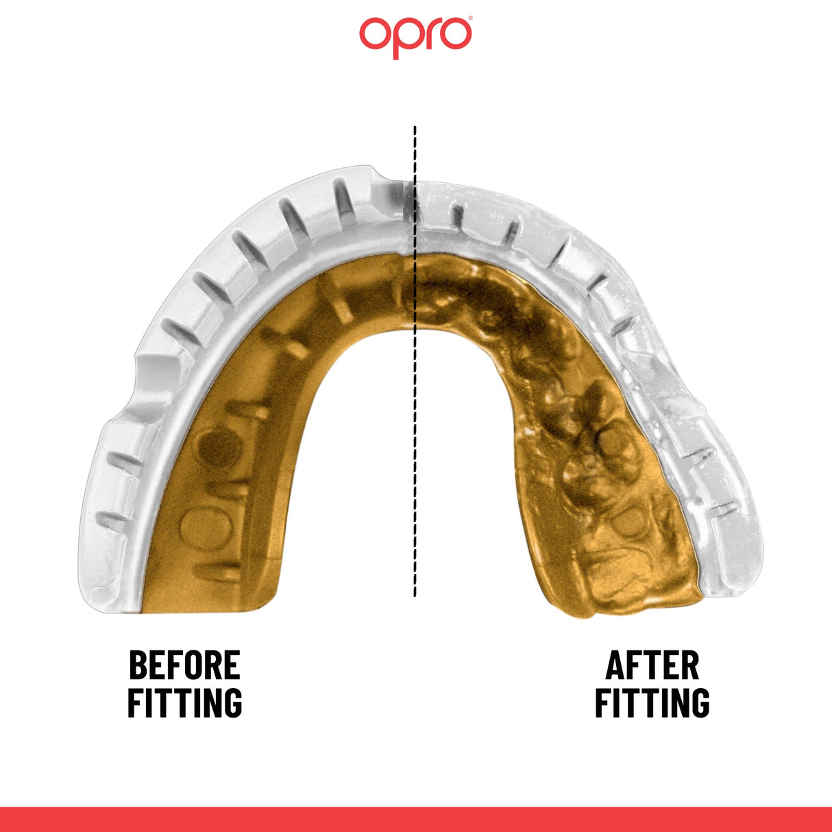 Gold Level Red Mouthguard for Braces