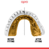 Gold Level Red Mouthguard for Braces