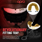 Gold Mouthguard for Braces (Clear)