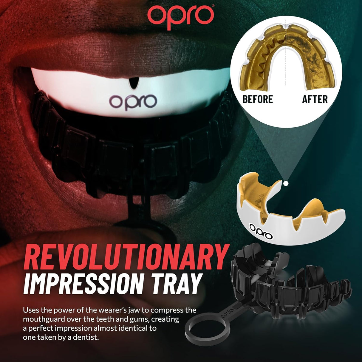 Instant Custom-Fit White Mouthguard for Braces