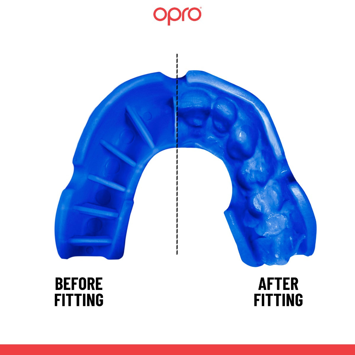 Bronze Level Blue Mouthguard
