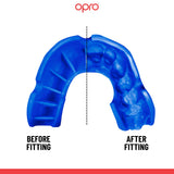 Bronze Level Blue Mouthguard