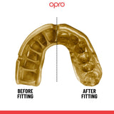 Gold Level Black Mouthguard