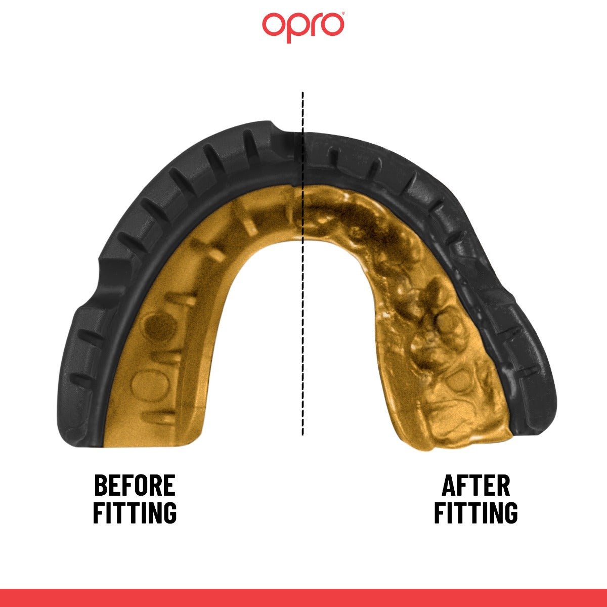 Gold Level Black Mouthguard for Braces