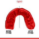 Gold Level England Rugby Mouthguard