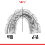 Instant Custom-Fit Fusion Braces Red
