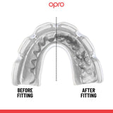 Instant Custom-Fit Clear Mouthguard for Braces