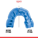 Silver Level Blue Mouthguard