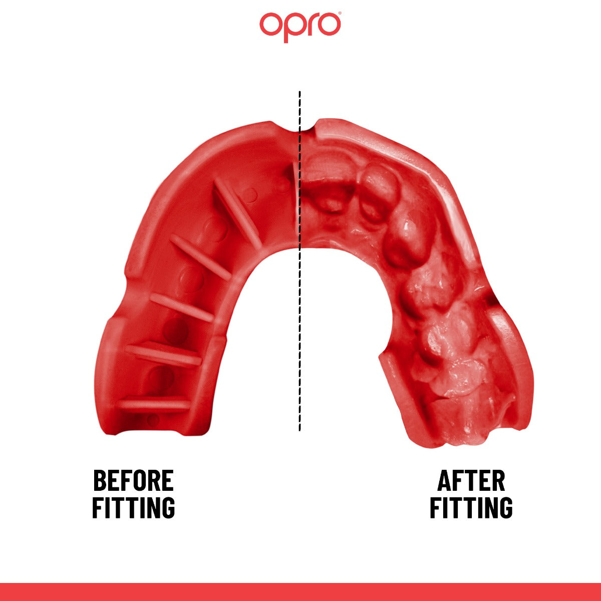 Silver Level Black Mouthguard