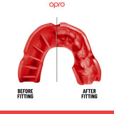 Silver Level Black Mouthguard