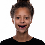 Snap-Fit Black Mouthguard