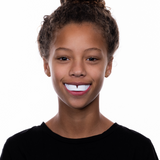 Snap-Fit White Mouthguard